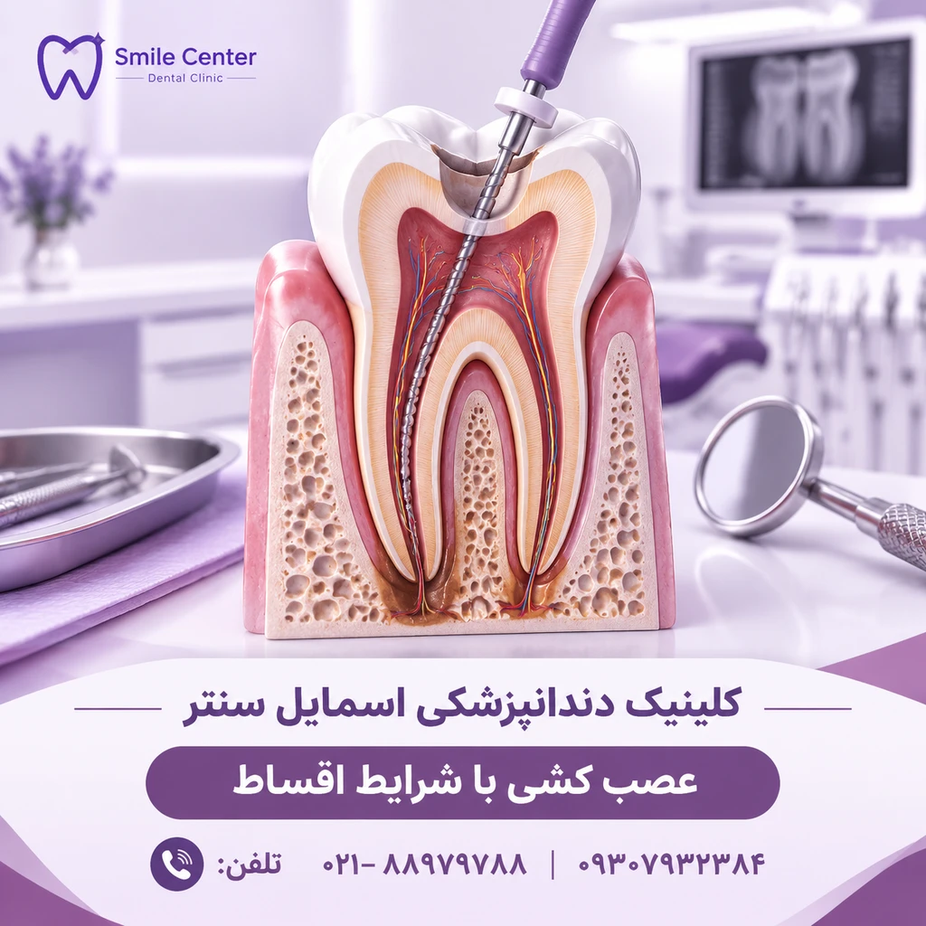 قیمت عصب کشی دندان